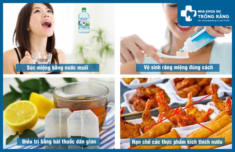 cac cach dieu tri sung nuou rang ham tren tai nha các cách điều trị sưng nướu răng hàm trên tại nhà