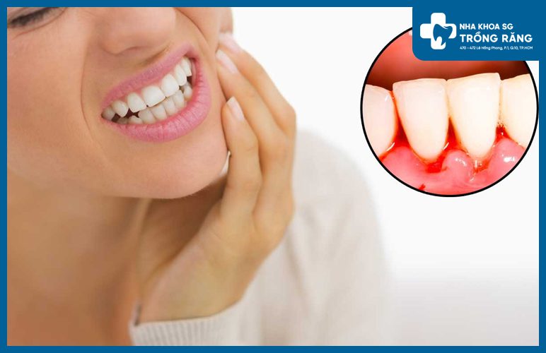 đau răng không ngủ được là gì