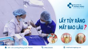 lấy tủy răng mất bao lâu