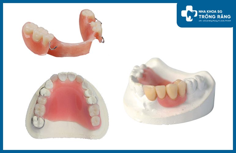 răng giả tháo lắp bán phần