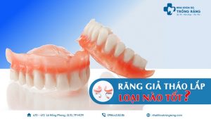 răng giả tháo lắp loại nào tốt nhất