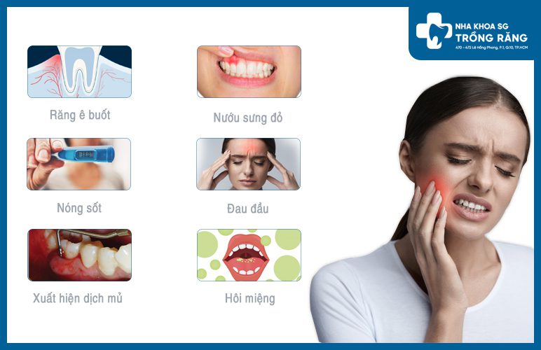 triệu chứng đau răng