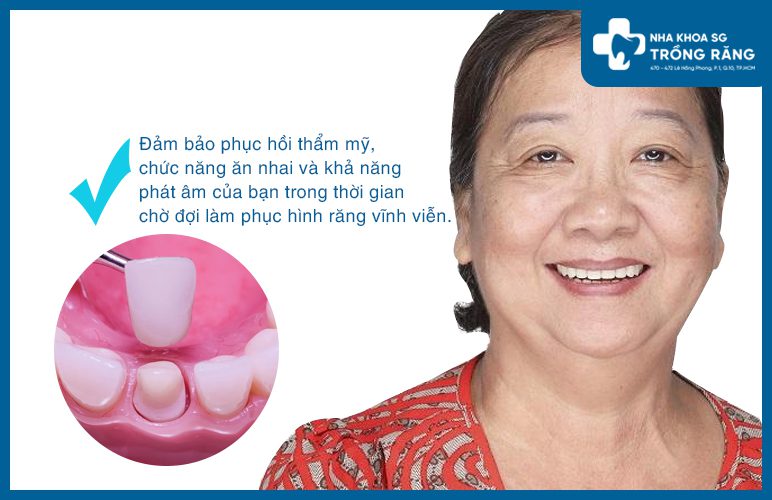 ưu điểm răng giả tạm thời