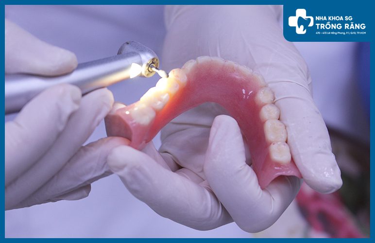 địa chỉ sửa chữa hàm răng giả tháo lắp