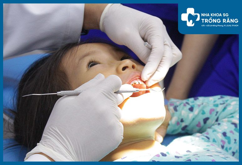kham rang sau cho be nhổ răng trẻ em bị sâu