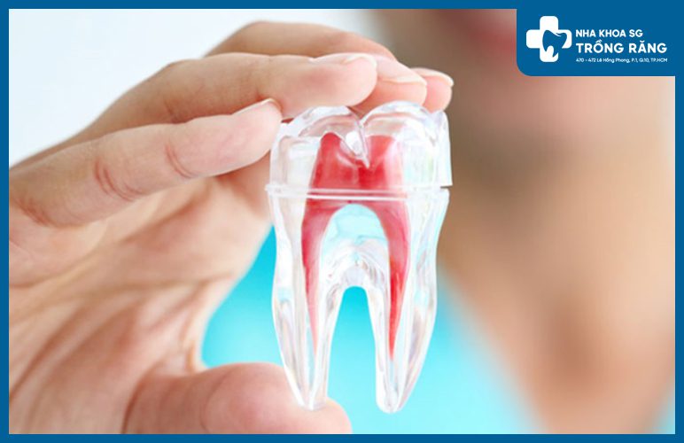 lấy tủy răng bằng máy có tốt không lấy tủy răng bằng máy có tốt không