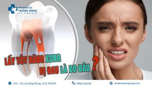 lấy tủy răng xong bị đau là do đâu