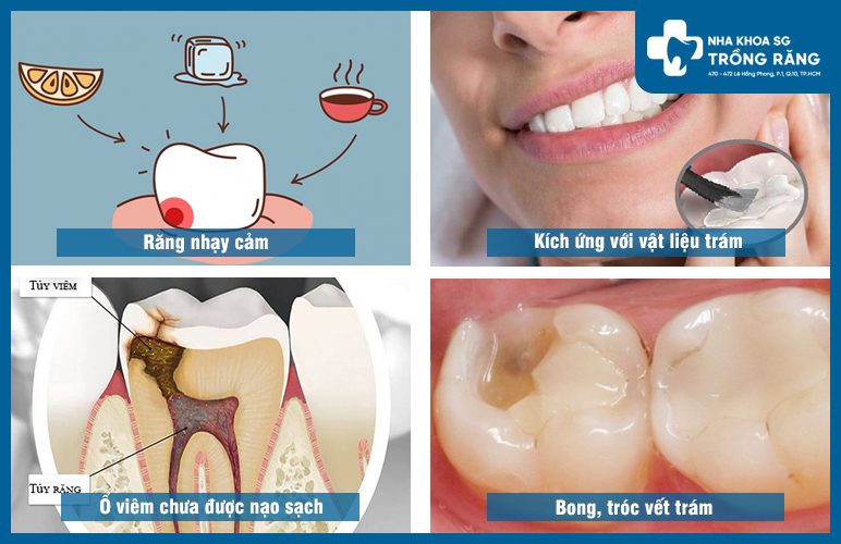 nguyen nhan tram rang xong bi dau nguyên nhân trám răng xong bị đau