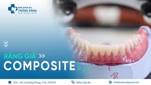 răng giả composite là gì