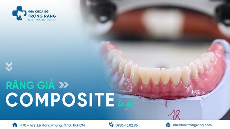 răng giả composite là gì