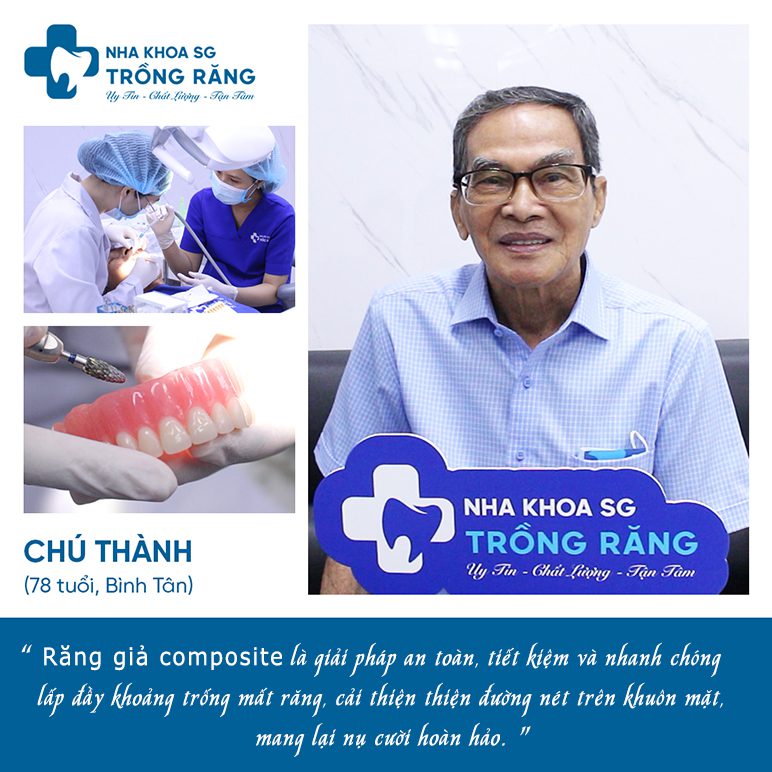 review trồng răng giả composite