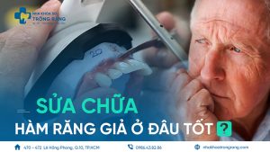 sửa chữa hàm răng giả ở đâu tốt