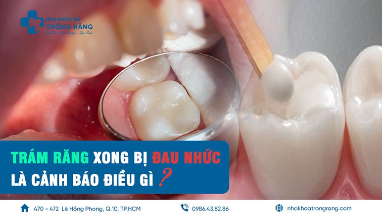 trám răng xong bị đau nhức là do đâu
