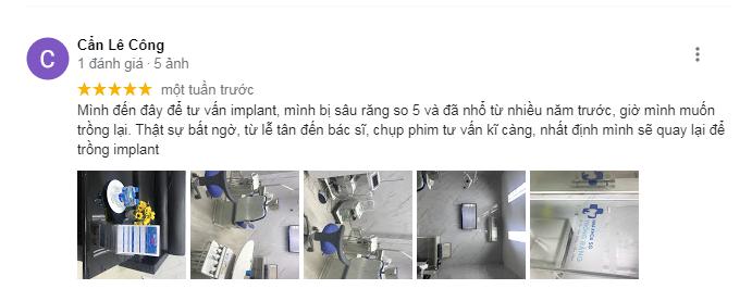 REVIEW VỀ NHA KHOA TRỒNG RĂNG SG