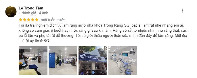 REVIEW VỀ NHA KHOA TRỒNG RĂNG SG