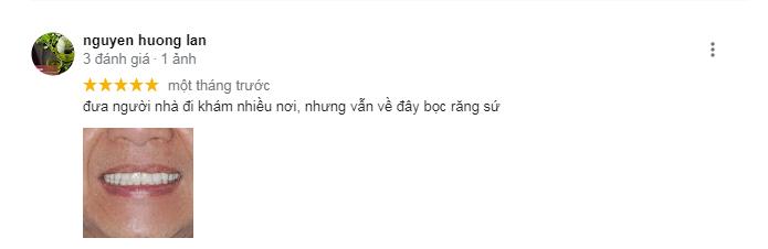 REVIEW VỀ NHA KHOA TRỒNG RĂNG SG