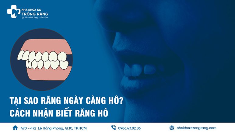 tại sao răng ngày càng hô