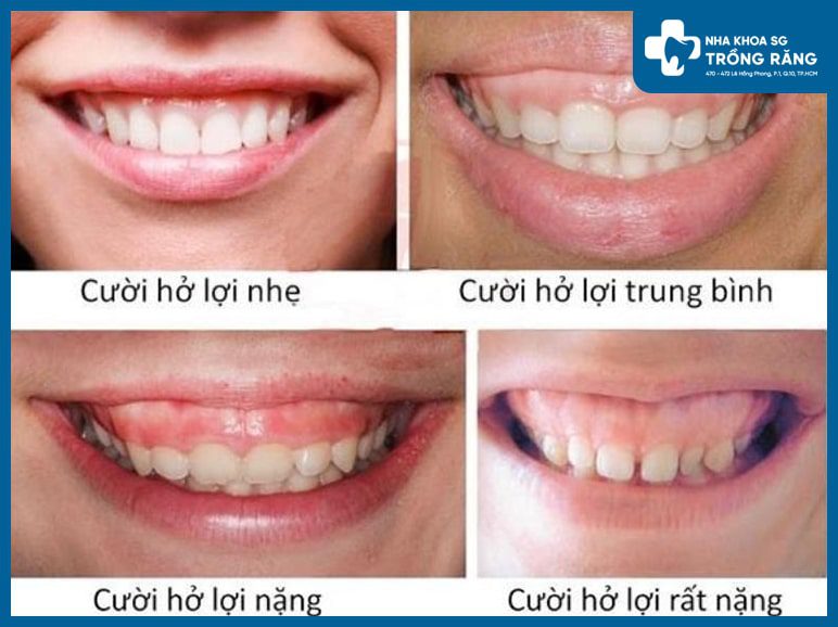 Truong hop nao thi can phai cat nuou min