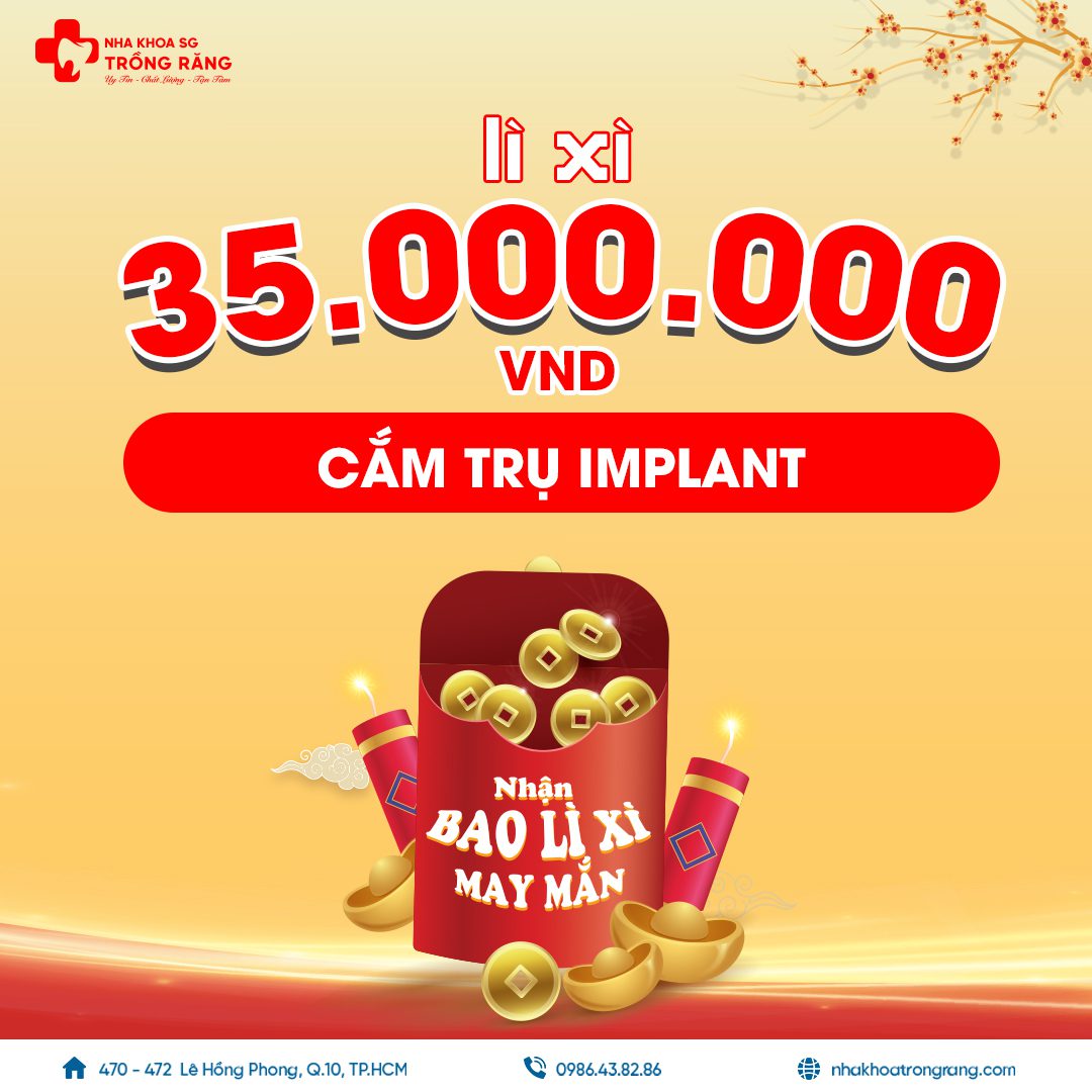 cay implant mien phi
