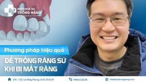 nhung phuong phap trong rang su hieu qua khi mat rang