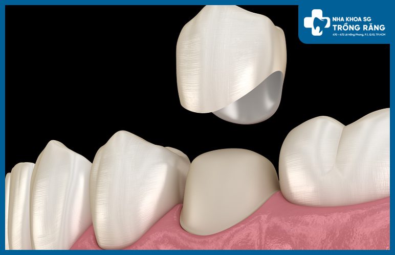 Boc rang su bi rot ra khong