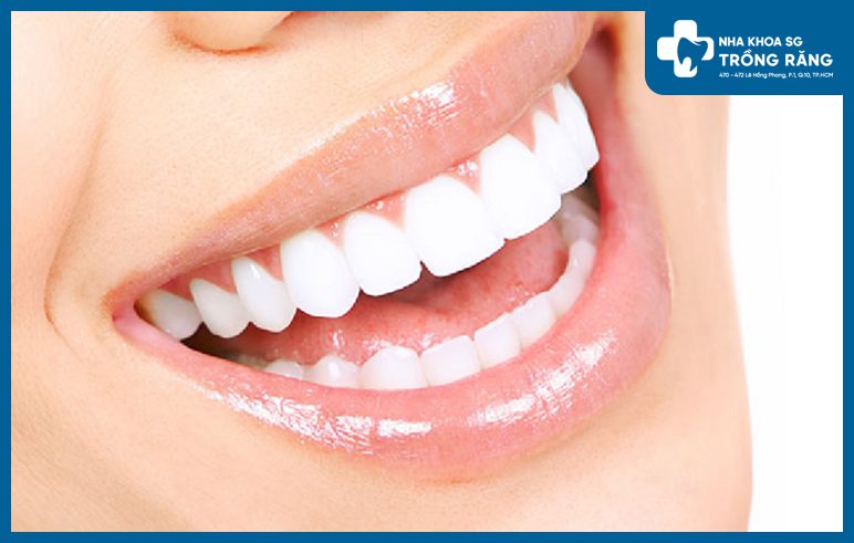 Bao nhiêu tuổi có thể làm răng sứ?