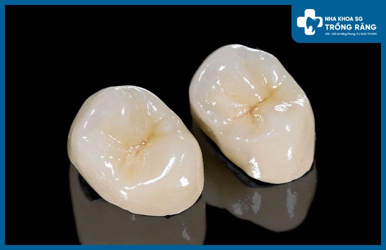 Bọc sứ răng hàm trên chọn loại nào tốt?