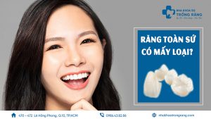 Rang toan su co may loai