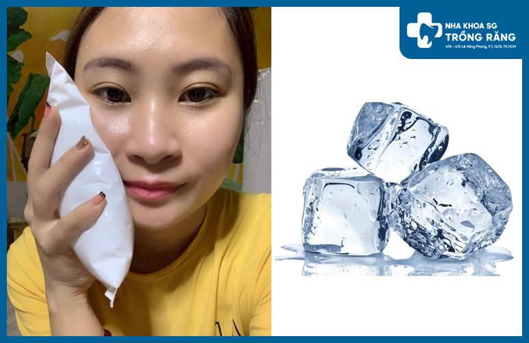 chuom lanh giam sung nuou rang khon Chườm lạnh giảm đau sau khi nhổ răng khôn