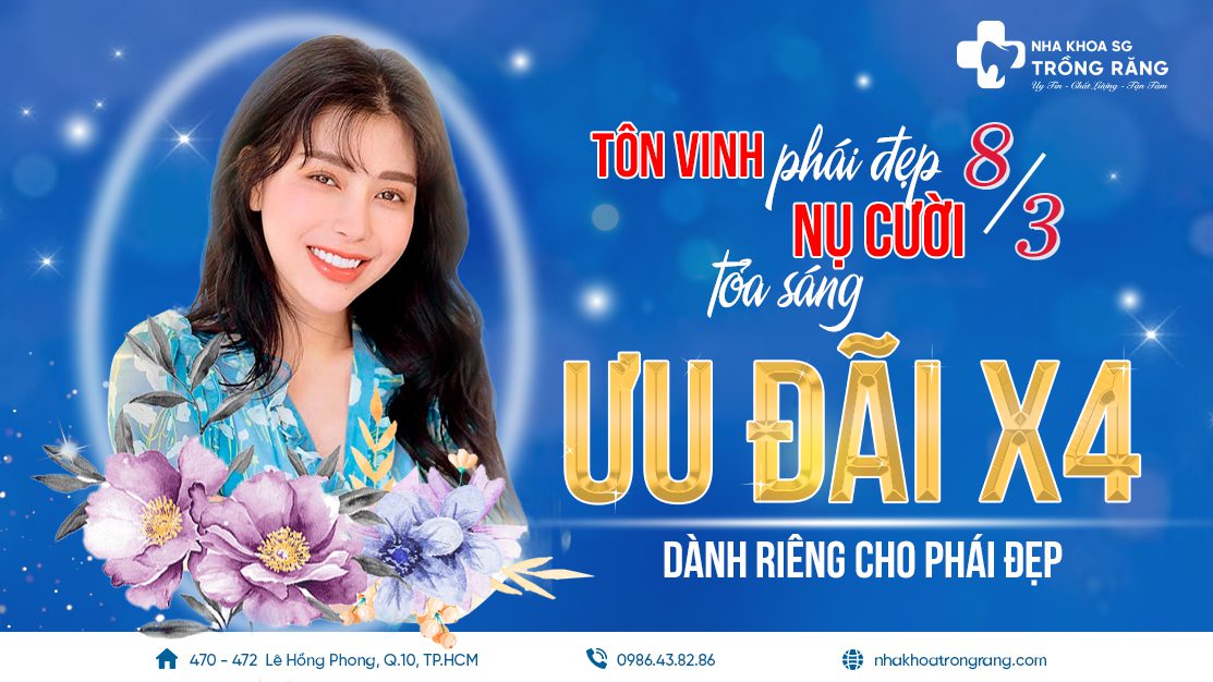 uu dai nhan 4 danh rieng cho phai dep