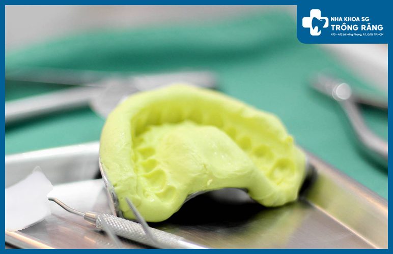 Lấy dấu mẫu hàm