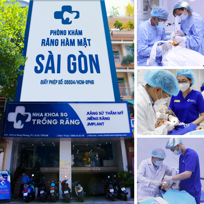 nha khoa trong rang sg