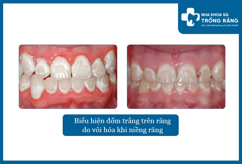 bieu hien dom trang tren rang do voi hoa khi nieng rang