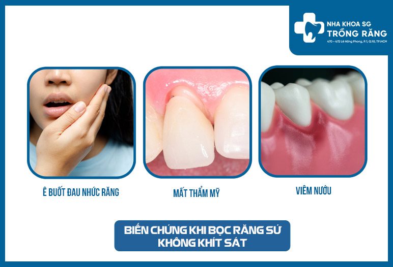 bien chung khi boc rang su khong khit sat