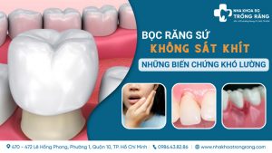 boc rang su khong khit sat