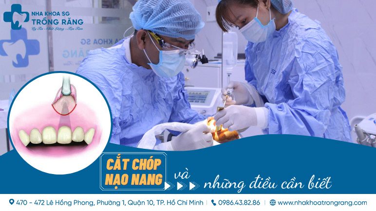 Cắt chóp nạo nang và những điều cần biết
