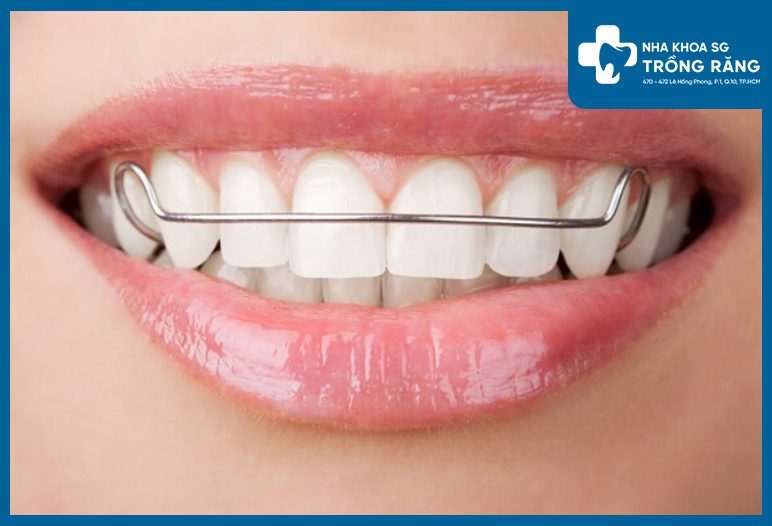 ham duy tri kim loai