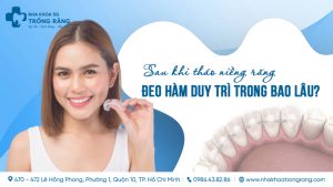 deo ham duy tri trong bao lau