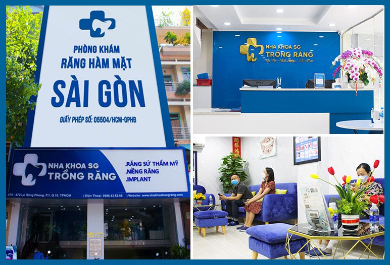nktrsg 1 nha khoa trồng răng sài gòn