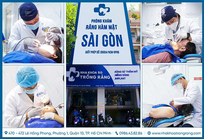 nha khoa trồng răng sài gòn