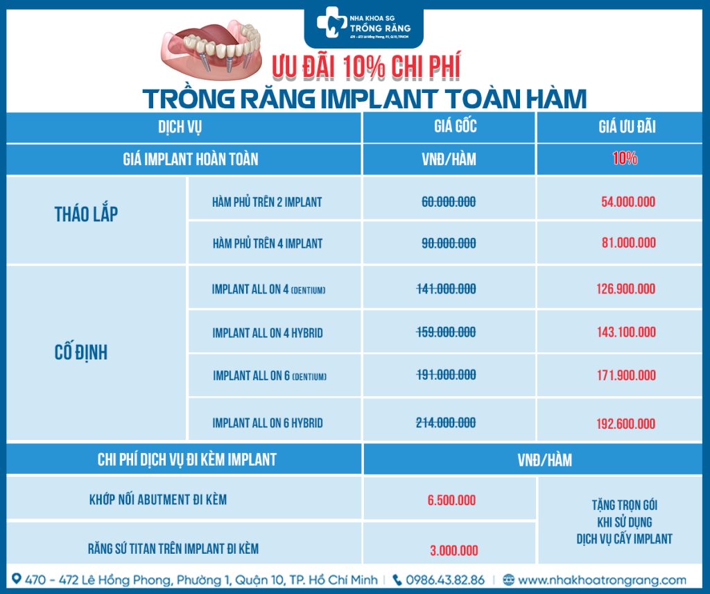 bang gia implant toan ham new Top 10 địa chỉ nha khoa implant hcm uy tín