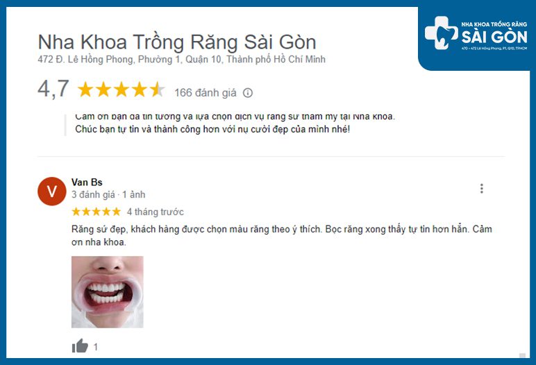 Đánh giá dịch vụ bọc sứ tại nha khoa trồng răng sài gòn