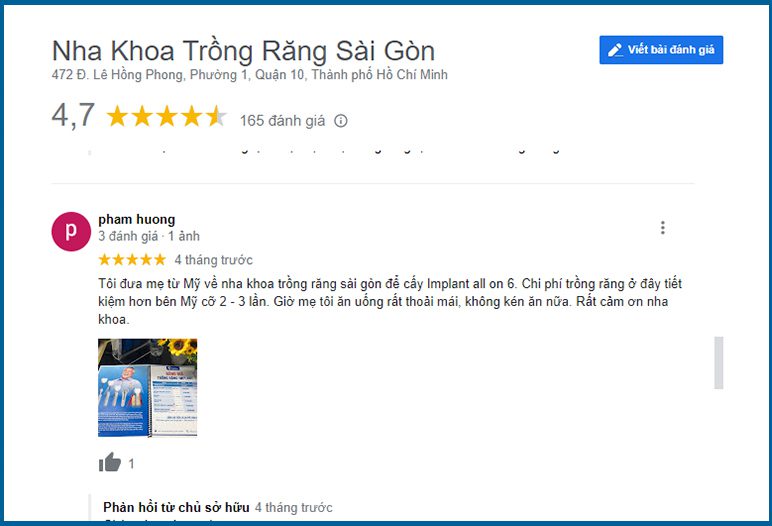review 1 1 Top 10 địa chỉ nha khoa implant hcm uy tín
