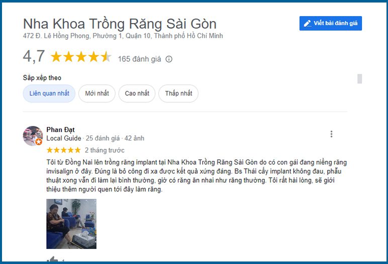 review 2 Top 10 địa chỉ nha khoa implant hcm uy tín