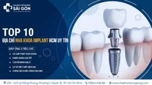 top 10 dia chi nha khoa implant hcm