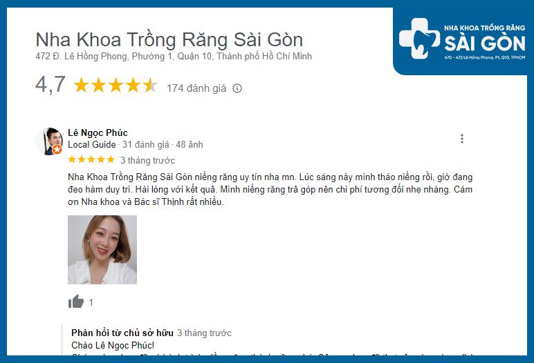 Review nha khoa niềng răng