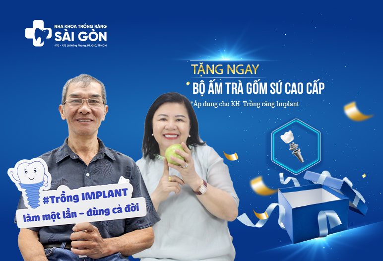 Ưu đãi trồng răng Implant 30/4 và 01/05