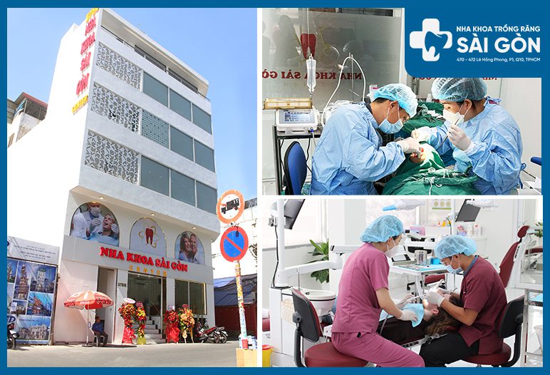 nha khoa sài gòn center