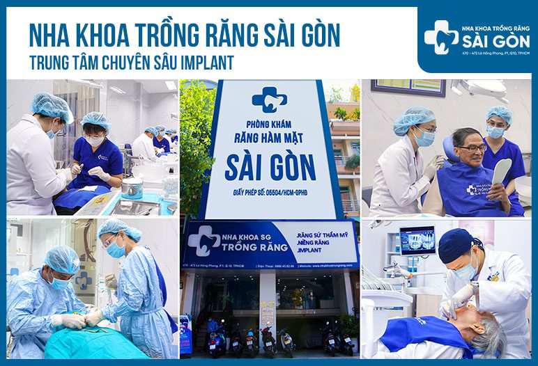 nha khoa trồng răng sài gòn