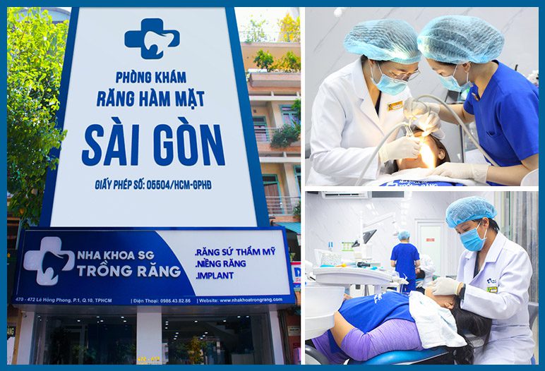 nha khoa trồng răng sài gòn